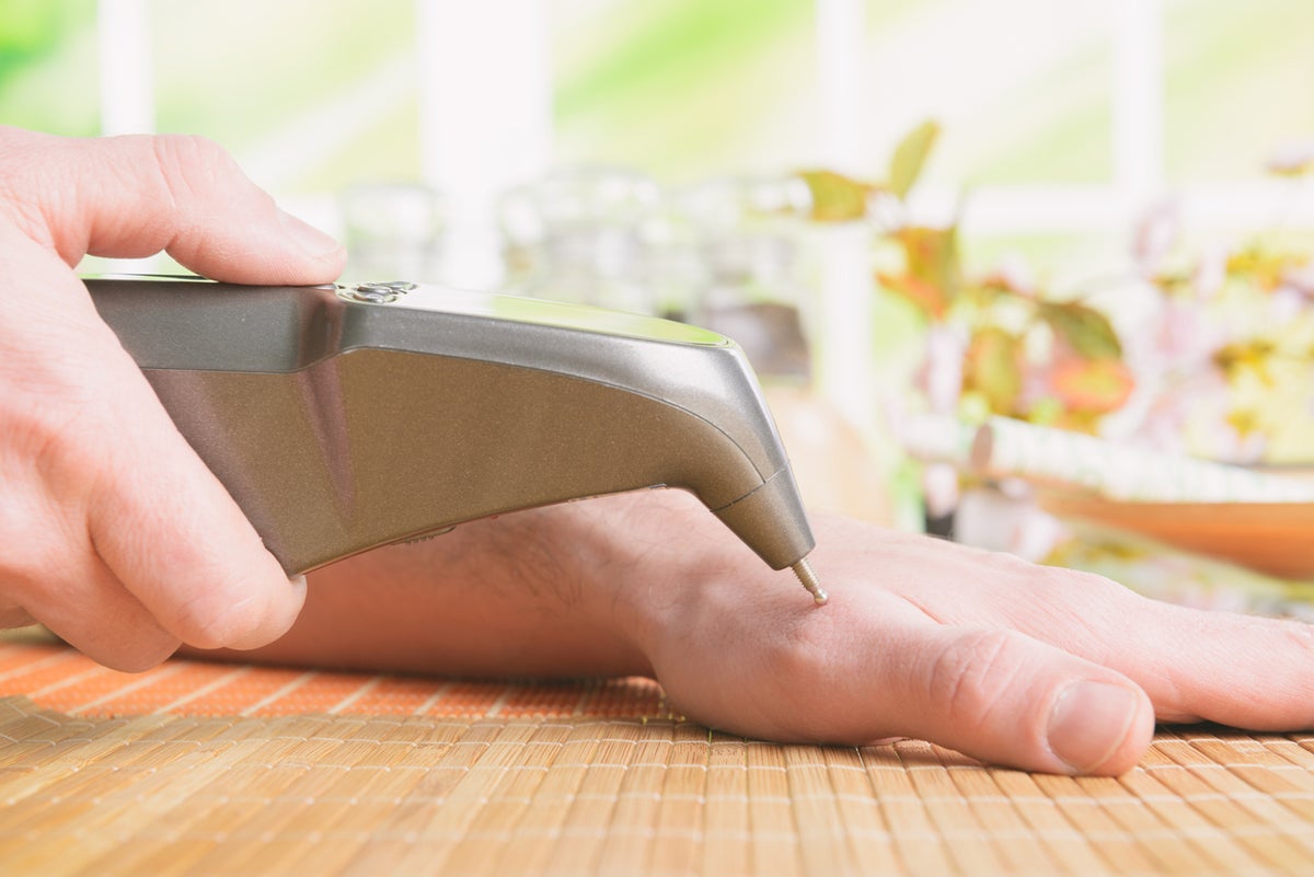 The Best Acupuncture Pens