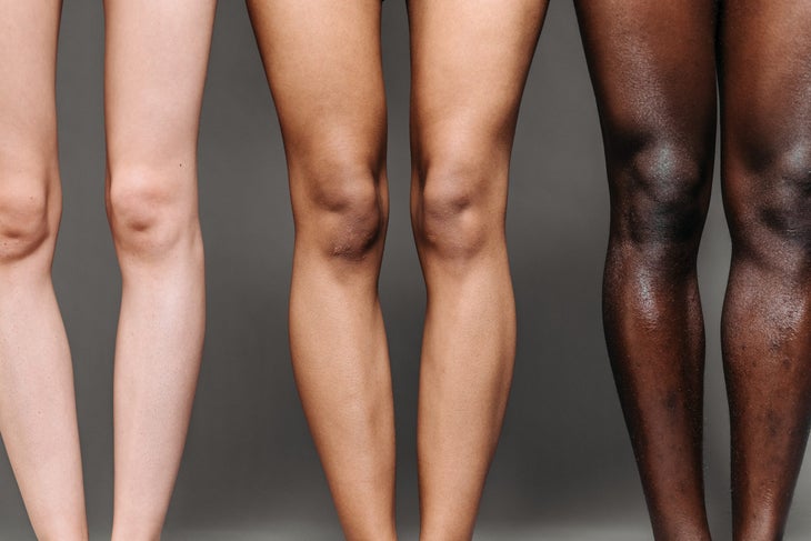 Three pairs of legs, three shades of skin